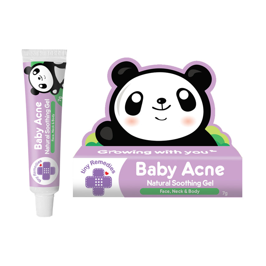 Tiny Buds Mini Baby Acne Natural Soothing Gel (7g) Tiny Buds Baby