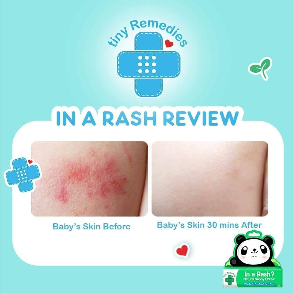 In a Rash Diaper Rash Cream - PPS – Tiny Buds Baby Naturals