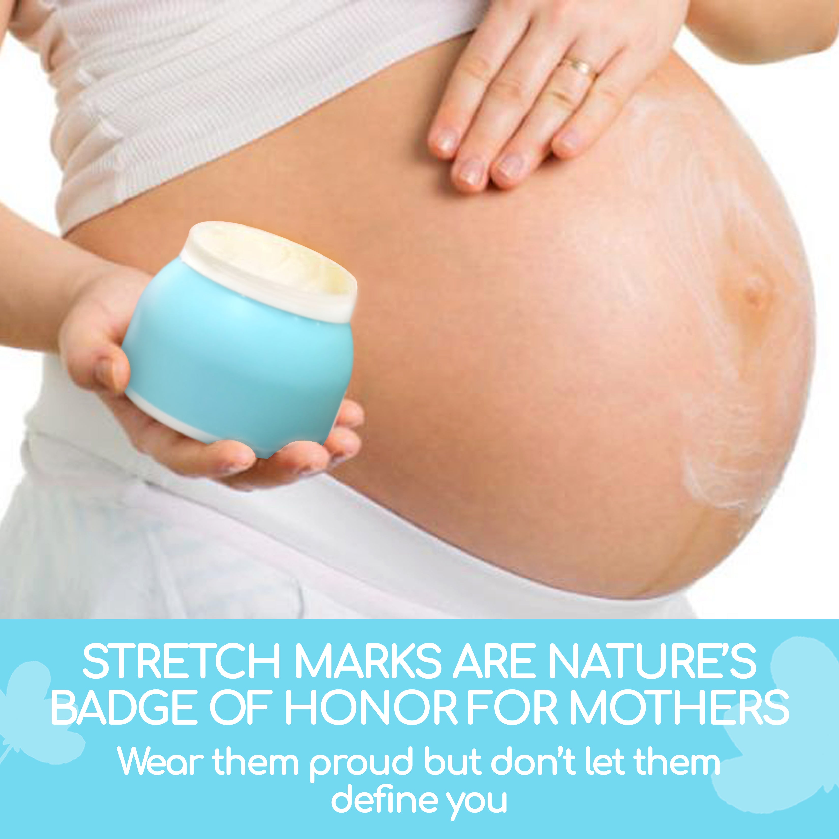 Smooth Moves Stretch Mark Oil 150ml, BLOOM AND BLOSSOM
